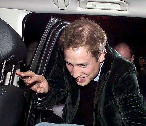 is prince william balding. Is+prince+william+ald