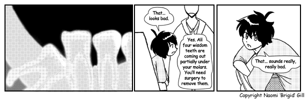Dental x-rays.