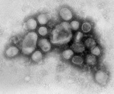 CDC's EM of H1N1 Swine Flu